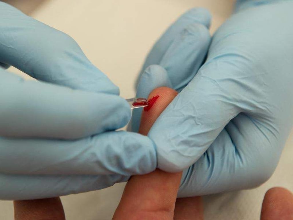 Zuwenig Vitamin B 12 im Blut? Dies lässt sich mit einer Blutuntersuchung überprüfen. Foto: Tim Brakemeier