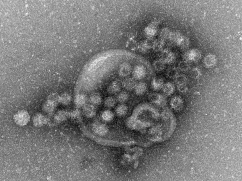 Elektronenmikroskopische Aufnahme von Noroviren. Foto: Gudrun Holland/Robert-Koch-Institut/Archiv