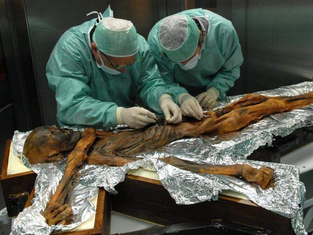 Forscher sind bei der Probenahme des Mageninhaltes der Mumie Ötzi. Foto: M.Samadelli/Southtyrolarchaeologymuseum\Eurac via Eurekalert