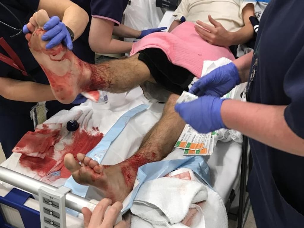 Der 16-jährige Schüler war nach einem Bad im Meer mit heftig blutenden Beinen ins Krankenhaus gebracht worden. Foto: AAP