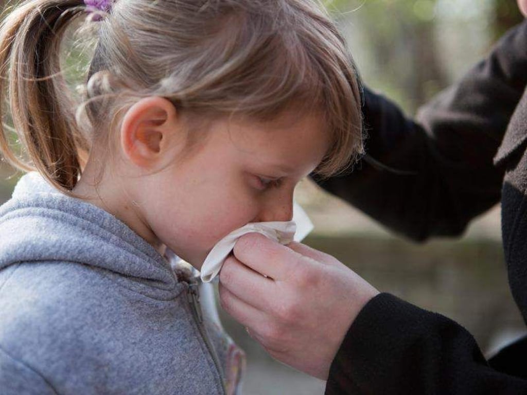 Unangenehm, aber bei Kindern oft harmlos: Nasenbluten. Foto: Silvia Marks