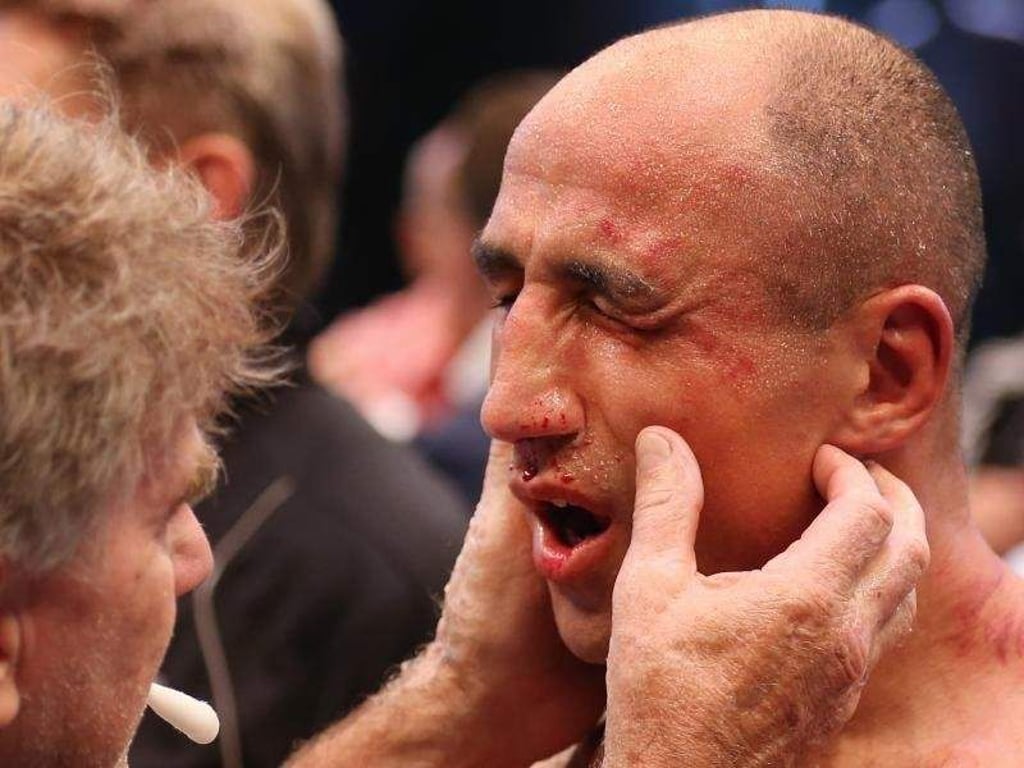 Arthur Abraham erlitt beim Kampf gegen Robert Stieglitz einen Anbruch des Oberkiefers. Foto: Friso Gentsch