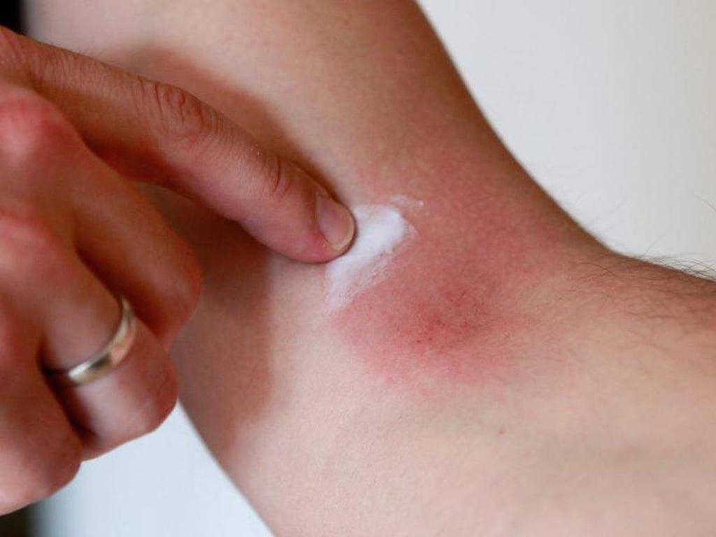 Wenn Kinder an Schuppenflechte leiden, erhöht sich das Risiko für andere Erkrankungen wie Bluthochdruck oder Diabetes. Foto: Silvia Marks/dpa-tmn