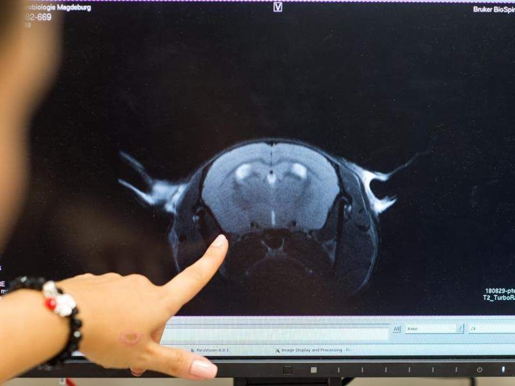 Ein Magnetresonanztomographen-Scan eines Mausgehirns. Foto: Klaus-Dietmar Gabbert