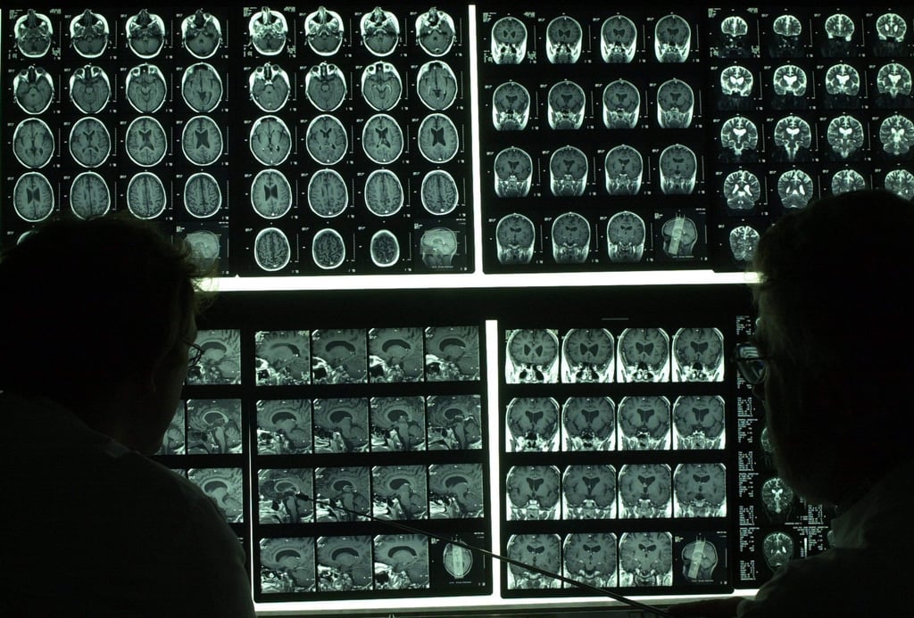 Mediziner des Institutes für Diagnostische und interventionelle Radiologie der Jenaer Friedrich-Schiller-Universität betrachten am 16.07.200 Schichtaufnahmen eines Gehirns, die mit einem modernen Magnetresonanztomographen aufgenommen worden sind. In Jena war 1924 das Prinzip der Elektroenzephalogie - der Messung von Hirnströmen - entdeckt worden, das bis heute wichtigste Diagnostikmittel zur Erkennung von Epilepsie ist. dpa/lth +++ dpa-Bildfunk +++