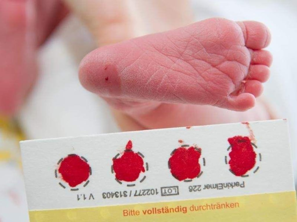 Ein Mukoviszidose-Test gehört bislang nicht zum standardmäßigen Neugeborenen-Screening in Deutschland. Foto: Stefan Sauer