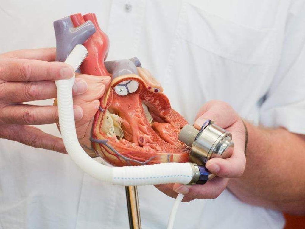 Kunstherzsystem "Heartmate III" an einem Herzmodell. Die verfügbaren Spenderorgane decken beileibe nicht den Bedarf herzkranker Menschen. Umso mehr Patienten sind daher auf Kunstherzen angewiesen. Foto: Julian Stratenschulte