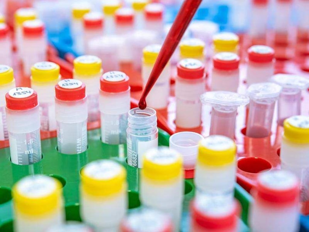 Drei Tage vor der PR-Aktion hatte die Pressesprecherin des Klinikums den Vorstand gewarnt. Foto: Labor/Universitätsklinikum Heidelberg