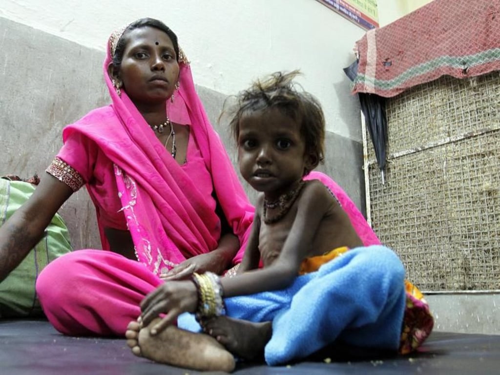 Eine indische Mutter sitzt mit ihrem unternernährten Kind in ihrer Wohnung in Bhopal. Foto: Sanjeev Gupta