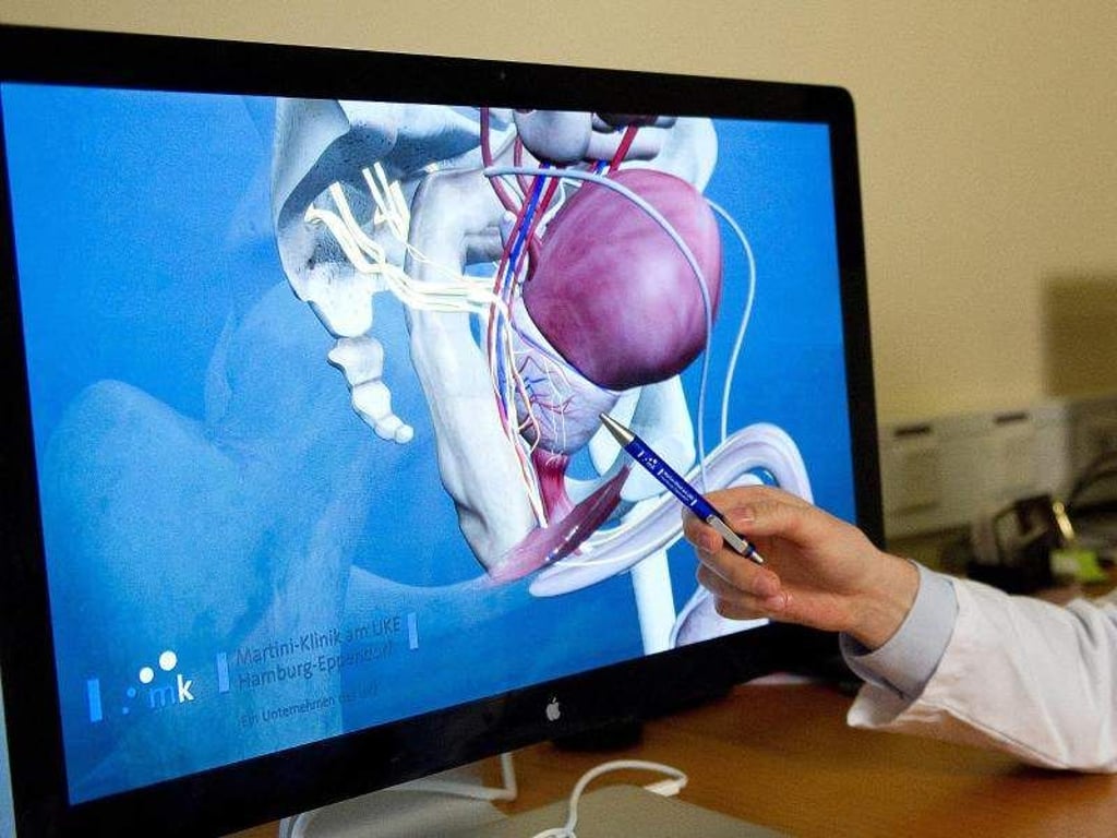3D-Modell einer Prostata im Universitätsklinikum Hamburg-Eppendorf. Foto: Axel Heimken