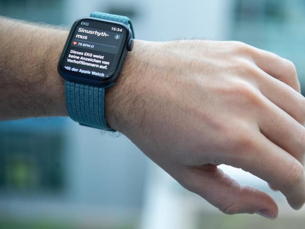 Alles in Ordnung. Diese Messung der Apple Watch hat einen normalen Herzrhythmus beim Träger erkannt. Foto: Andrea Warnecke