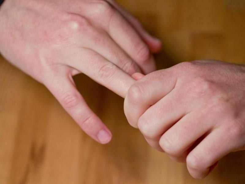 Das knackende Geräusch beim Auseinanderziehen von Fingern entsteht durch die Bildung eines Hohlraums im Gelenk. Foto: Daniel Karmann
