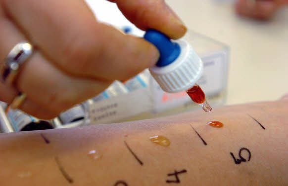 Allergietest