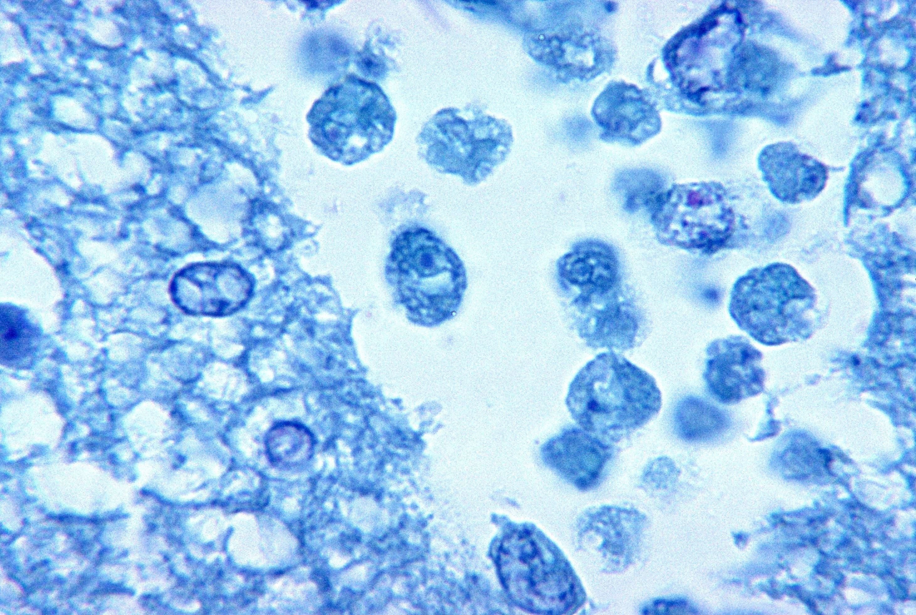 Die extrem gefährliche Amöbenart „Naegleria fowleri“ soll für den Tod einer 18-jährigen US-Amerikanerin verantwortlich sein.