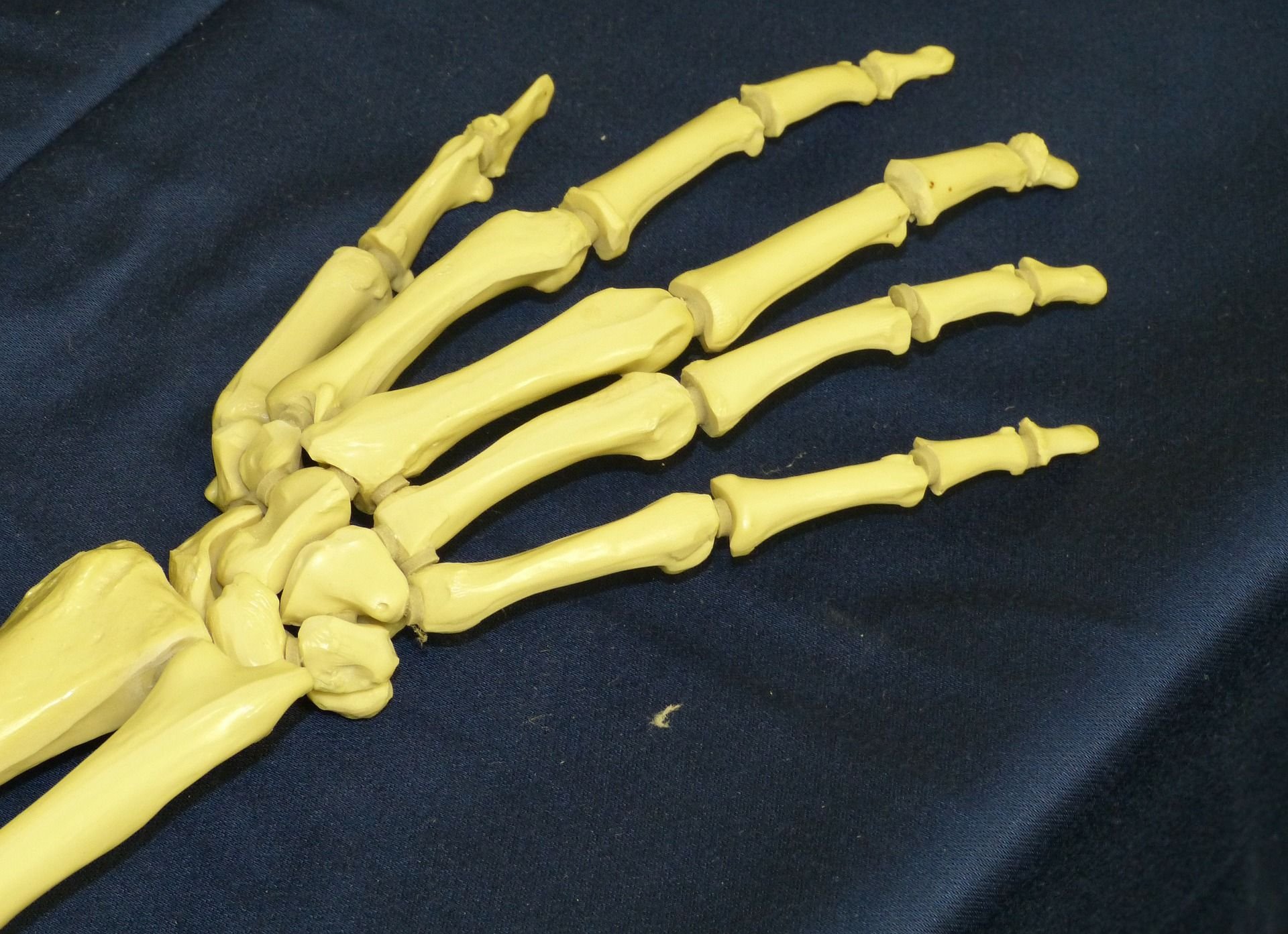 Eine künstliche Skeletthand wird in einer Ausstellung gezeigt.