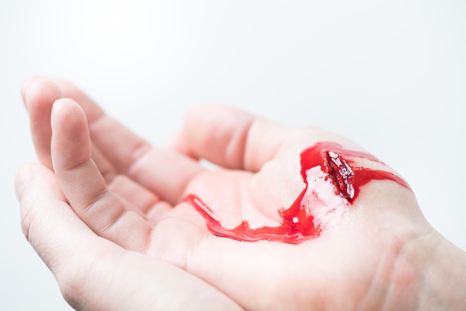 Dringen Keime in eine Wunde ein, kann sich eine lebensgefährliche Blutvergiftung entwickeln.