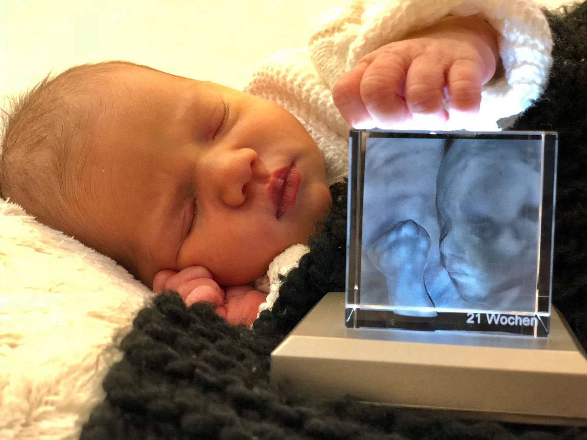 Baby in 3D