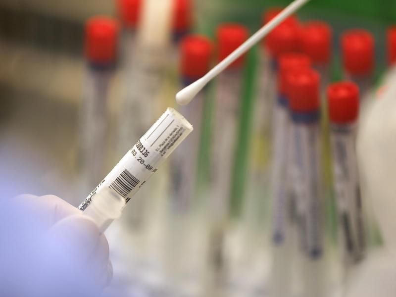 Im Labor werden zum Nachweis einer Infektion Abstriche aus dem Nasen-Rachen-Raum auf das Sars-CoV-2-Virus getestet. Foto: Oliver Berg/dpa/Archivbild
