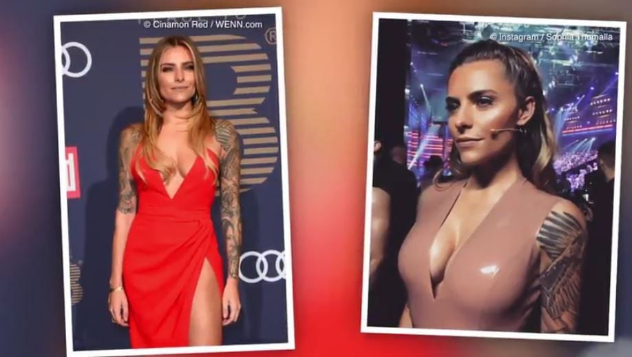 Sophia Thomalla nach und vor ihrer Burst-OP.