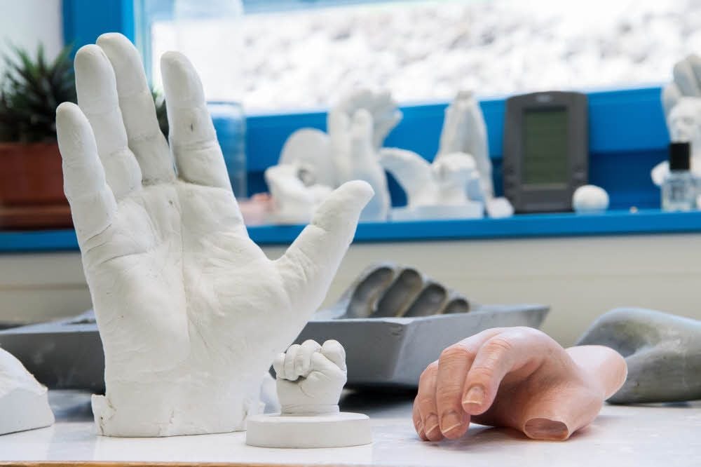 Riesige Männerhände und winzige Babyfäuste: In der Werkstatt für Silikonprothesen des Sanitätshauses Klinz sieht es aus wie in einem Künstleratelier.