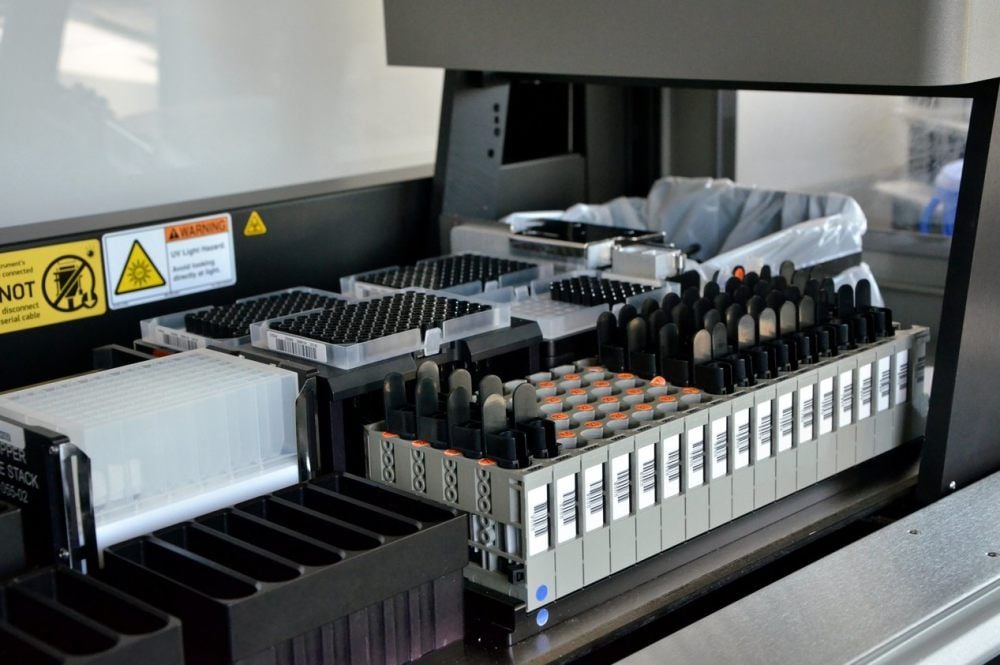 Ein Automat filtert das zu untersuchende Genmaterial aus dem Abstrich.