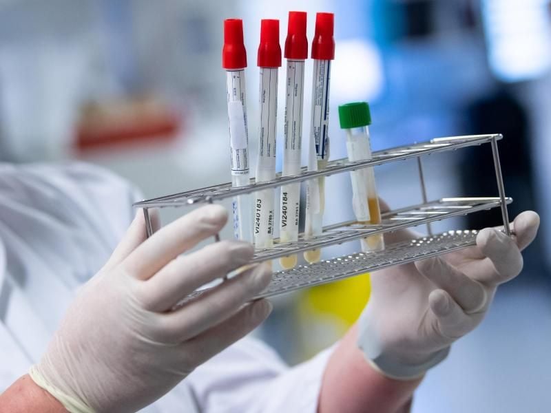 Eine Laborantin bereitet Corona-Proben für die weitere Analyse vor. Foto: Sven Hoppe/dpa/Symbolbild