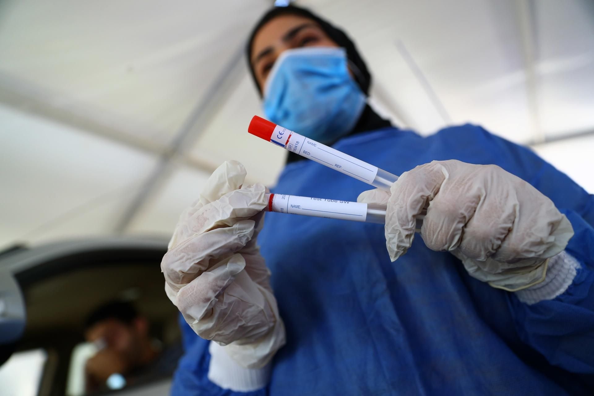 China warnt vor einem neuen, gefährlichen Lungenvirus (Symbolbild).