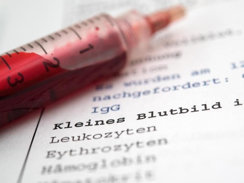 Ein Blutbild sieht für viele Patienten kryptisch und verwirrend aus. Am besten besprechen sie mit ihrem Arzt, was die Ergebnisse genau bedeuten. Foto: Andrea Warnecke