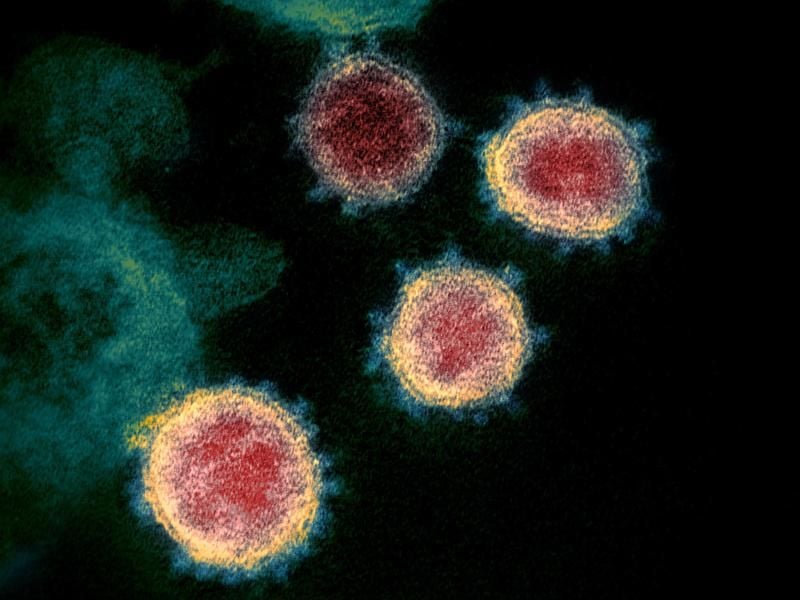 Undatierte elektronenmikroskopische Aufnahme zeigt das Virus, das COVID-19 verursacht. Foto: Uncredited/NIAID-RML/via Ap/dpa/Archivbild