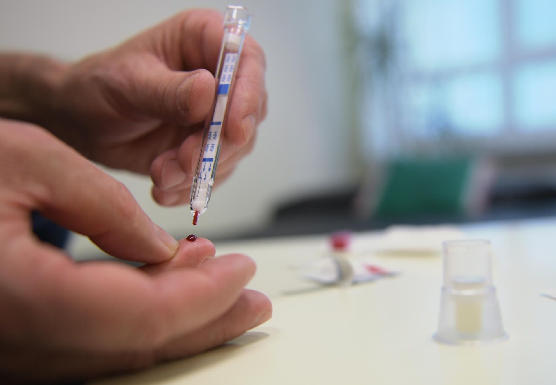 Ein junger Mann führt einen HIV-Heimtest durch.