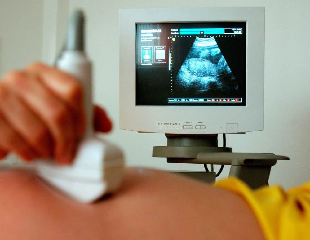 Eine Ultraschalluntersuchung während der Schwangerschaftsvorsorge