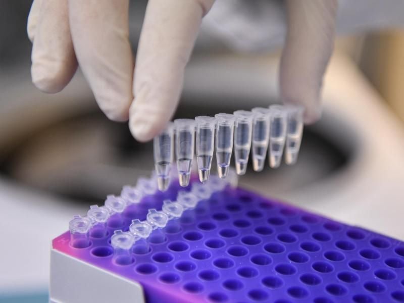 Eine Laborantin hält mehrere Proben toter Reiherenten für einen Test in der Hand. Foto: Felix Kästle
