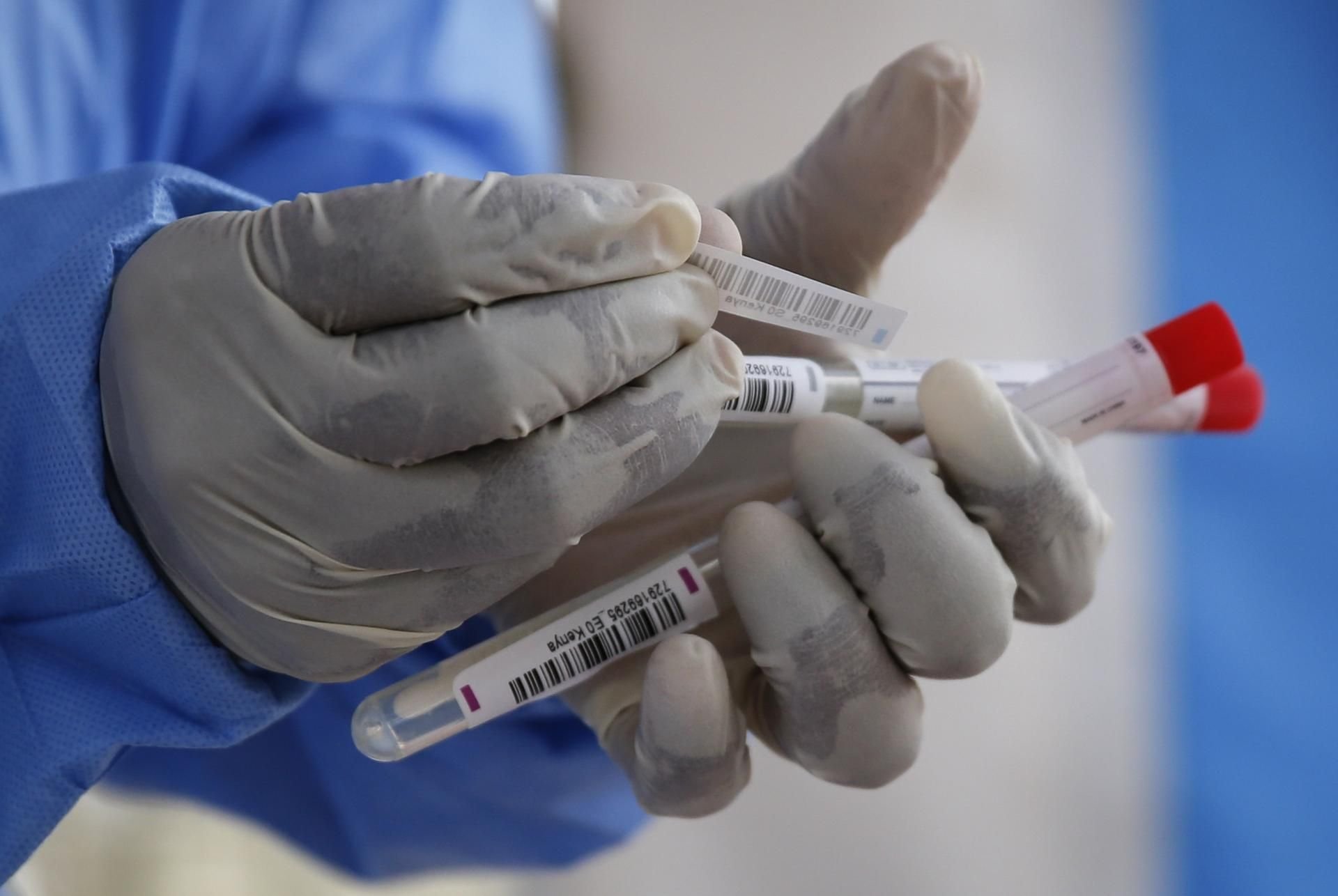 Die Stadt Halle hat am Samstag 19 Neuinfektionen mit dem Coronavirus gemeldet.