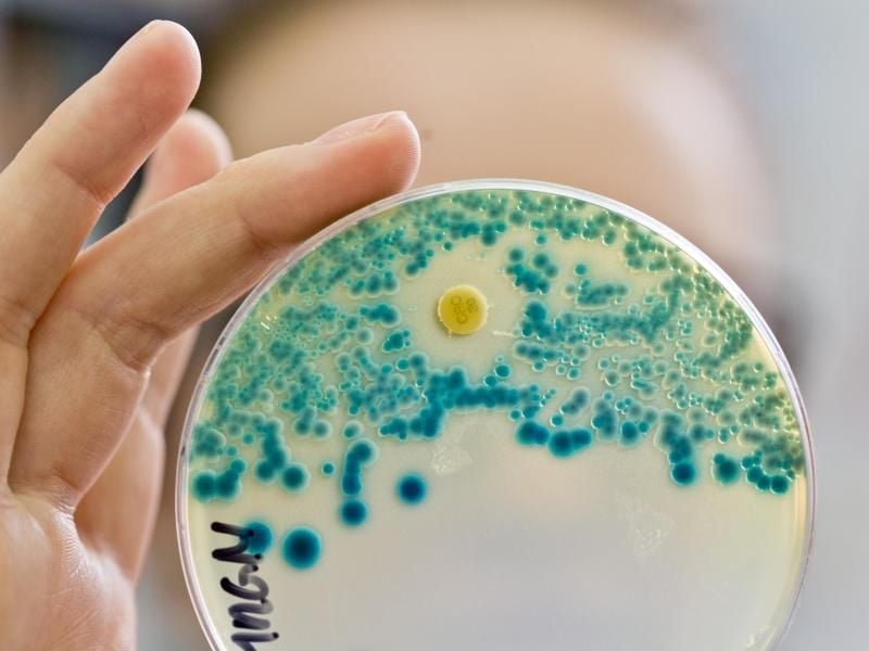 Nachweis von multiresistenten Bakterien: Viele Krankenhauspatienten bringen bereits von zu Hause die tödlichen Keime mit in die Kliniken. Foto: Daniel Karmann/Archiv