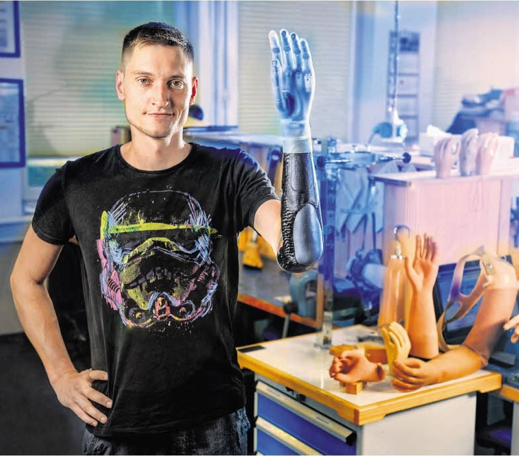 Sascha Mrongowius hat sich schnell an seine Hightech-Armprothese gewöhnt.