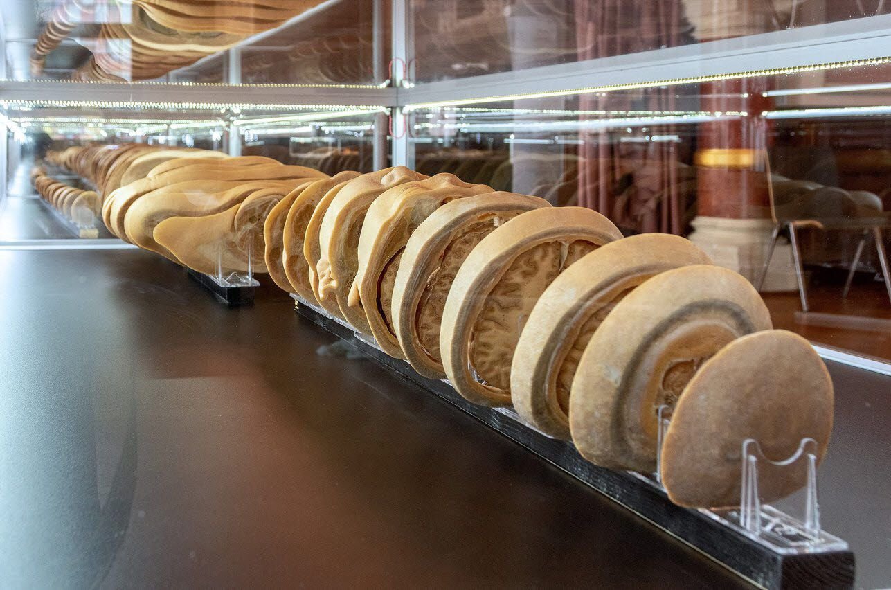 Der „Scheibenmann“ ist das Kernstück der Ausstellung. Das Präparat wurde von Kopf bis Fuß in 182 Scheiben zerteilt.
