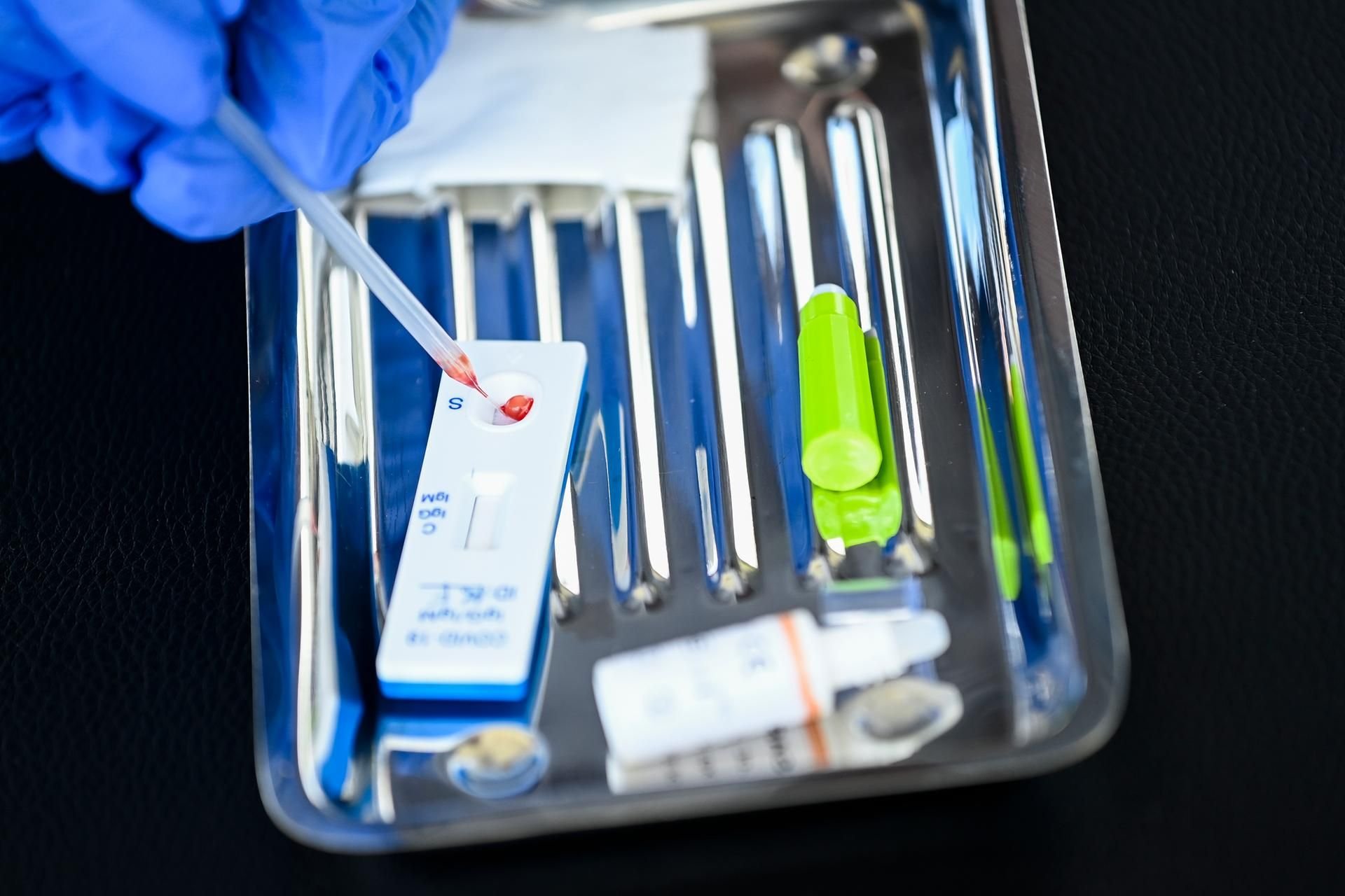 Illustration - Eine Blutprobe wird auf einen Test für das Coronavirus gegeben.
