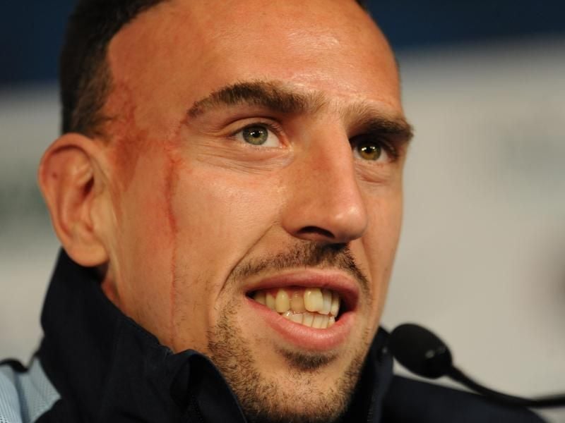 Fußballer Franck Ribery. Foto: Andreas Gebert/Archivbild