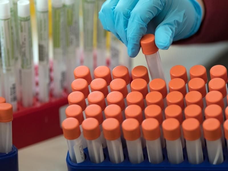 Wissenschaftler haben die Ansteckungsketten bei Sars-CoV-2 genauer untersucht. Demnach erfolgt eine Weitergabe des Virus oft vor den ersten Symptomen. Foto: Hendrik Schmidt/dpa-Zentralbild/ZB