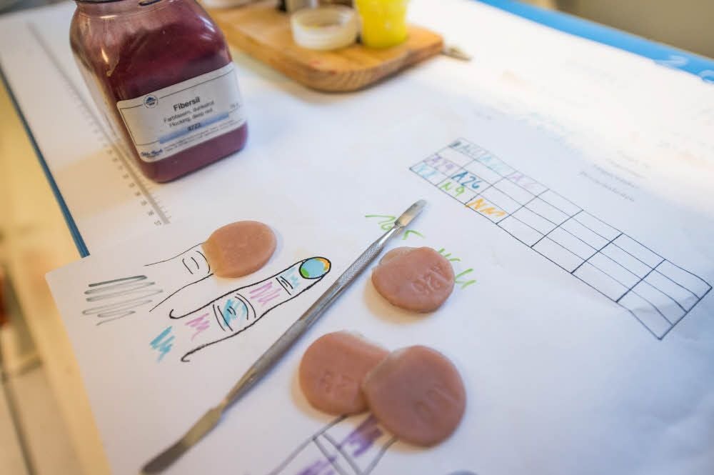 Orthopädietechniker Stefan Wandsleb fertigt eine Finger-Prothese: Die Hautfarbe wird mit vorher genommenen Proben abgestimmt und immer wieder verglichen.
