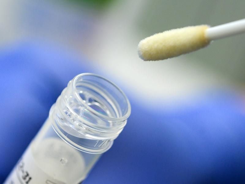 Ein Abstrich für das Testverfahren auf das Coronavirus. Foto: Sebastian Gollnow/dpa/Symbolbild