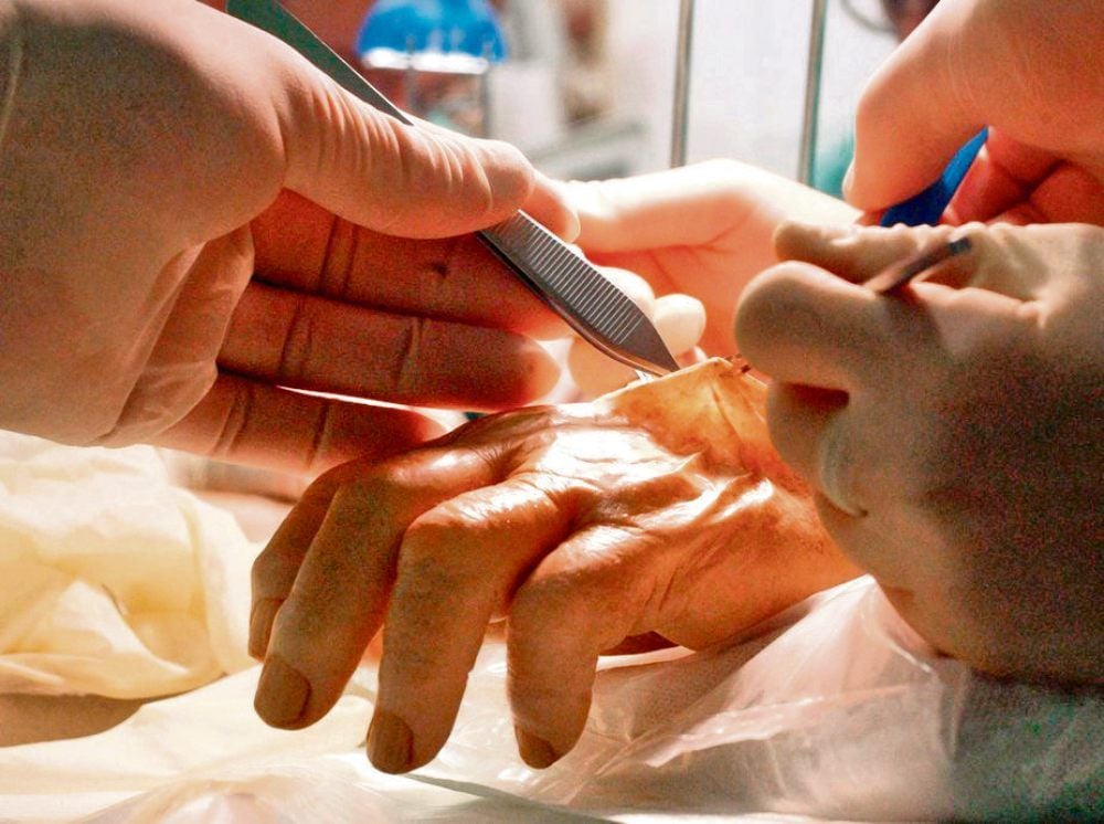 An der Hand dieser Leiche trainieren Handchirurgen der plastischen Chirurgie komplizierte Operationstechniken.