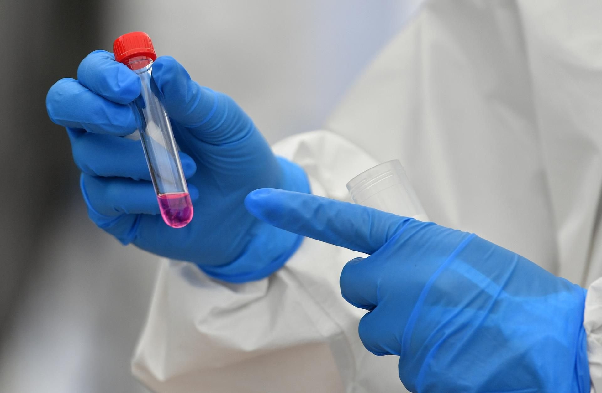 Laut einer US-amerikanischen Studie lässt sich die Ausbreitung des Coronavirus durch steigende Temperaturen nur geringfügig verlangsamen.