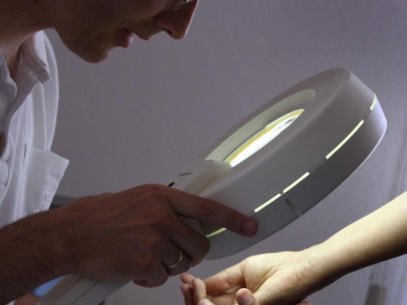 Bei der Hautkrebs-Früherkennung wird beim Dermatologen mit einem Vergrößerungsglas die Haut nach Veränderungen abgesucht. Foto: Klaus-Josef Hildenbrand