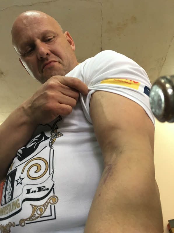 Ein Duell von Jan Sarembe endete Anfang des Jahres mit einer Verletzung. Bei einem Turnier war ihm die Bizeps-Sehne gerissen. Der Grund: Fehlendes Aufwärmen.