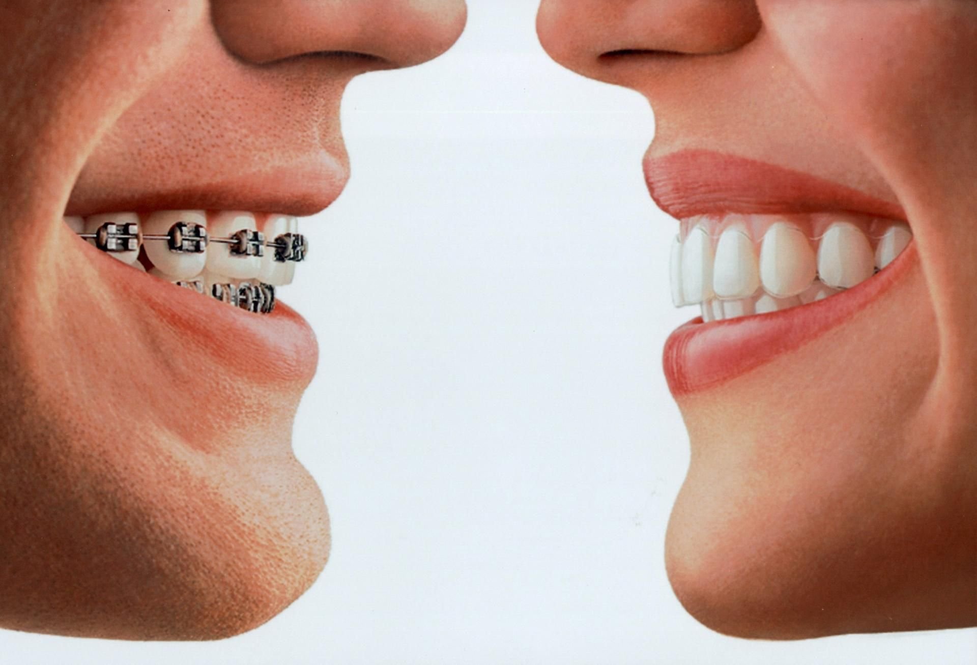 In Deutschland werden zu viele kieferorthopädische Behandlungen durchgeführt. (Symbolbild)