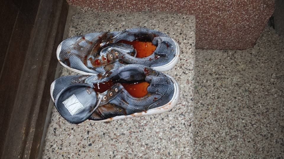 Mehrmals fanden Mitglieder der Initiative "Buntes Roßlau" blutig aussehende Schuhe vor ihrer Tür.