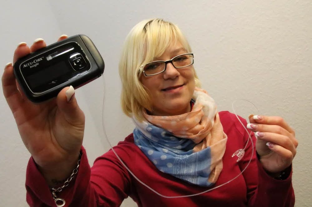 Yvonne König zeigt die Insulinpumpe, die sie rund um die Uhr am Körper trägt. Das Gerät gibt die nötigen Insulineinheiten automatisch unter die Haut.