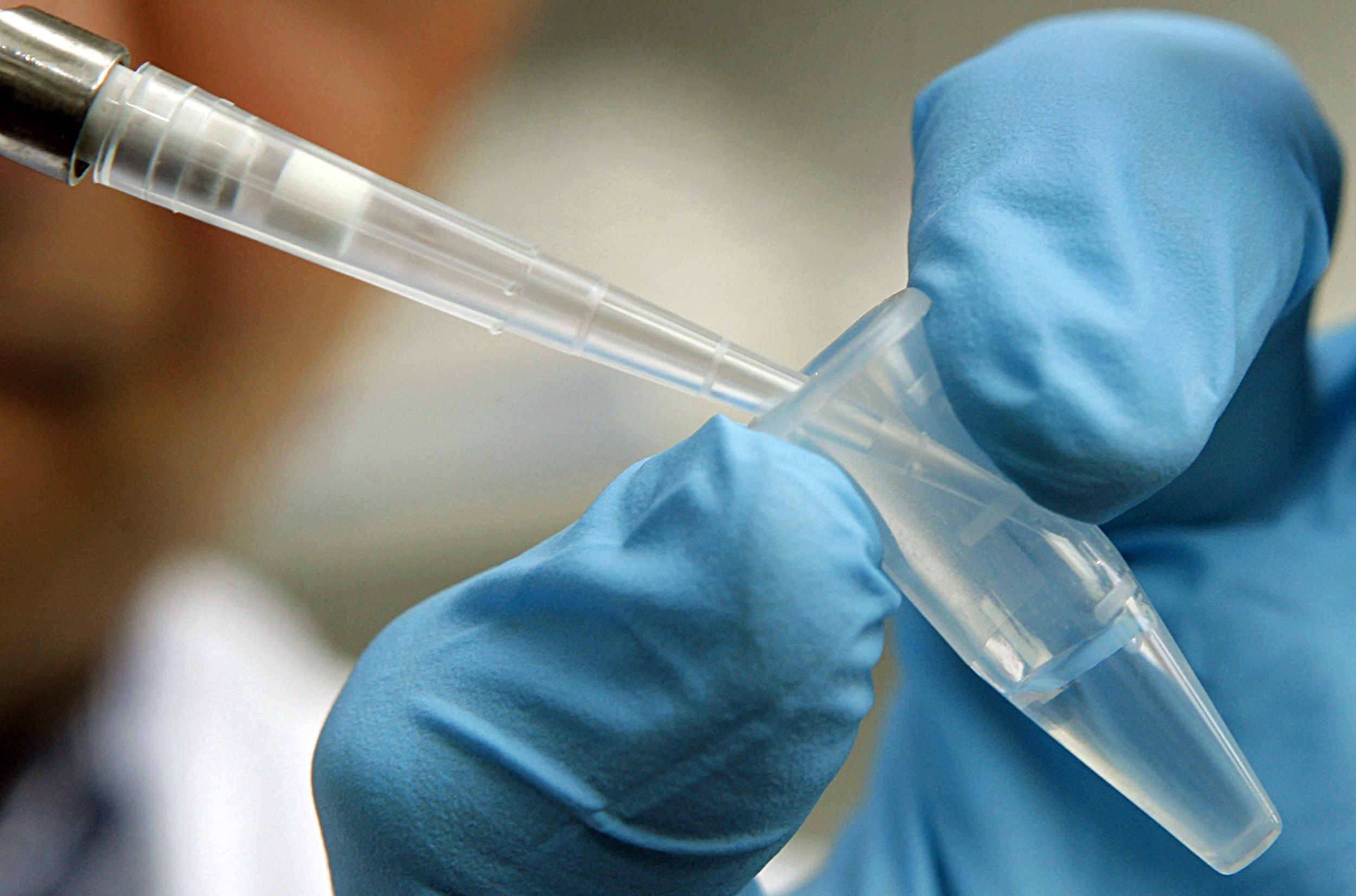 Probe zur Feststellung von DNA