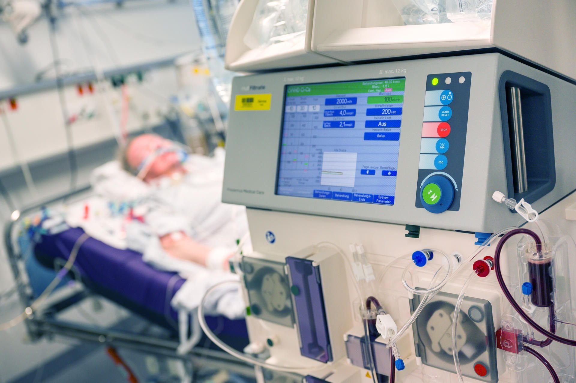 Ein Patient liegt während seines Aufenthalt im Krankenhaus in einem Intensivzimmer an einem Beatmungsgerät und einem Dialysegerät (im Vordergrund). (Symbolbild)